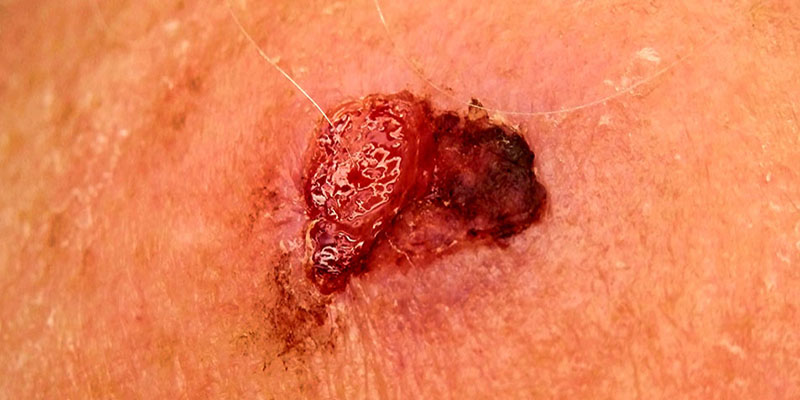 Card Image 2